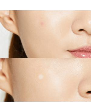 2 PCS. Cosrx Acne pimple master patch