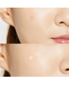 2 PCS. Cosrx Acne pimple master patch